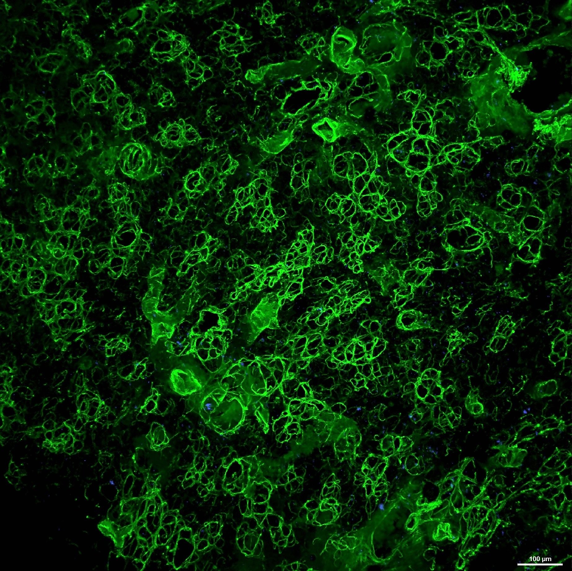 Fluorescence microscopy image